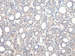 Invitrogen VPS33B Polyclonal Antibody 100 &mu;L; Unconjugated:Antibodies,
