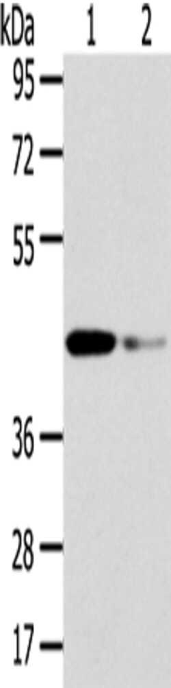 Invitrogen VPS37A Polyclonal Antibody 100 &mu;L; Unconjugated:Antibodies,