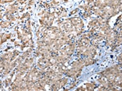 Invitrogen WDR4 Polyclonal Antibody 100 &mu;L | Buy Online | Invitrogen&trade; | Fisher Scientific