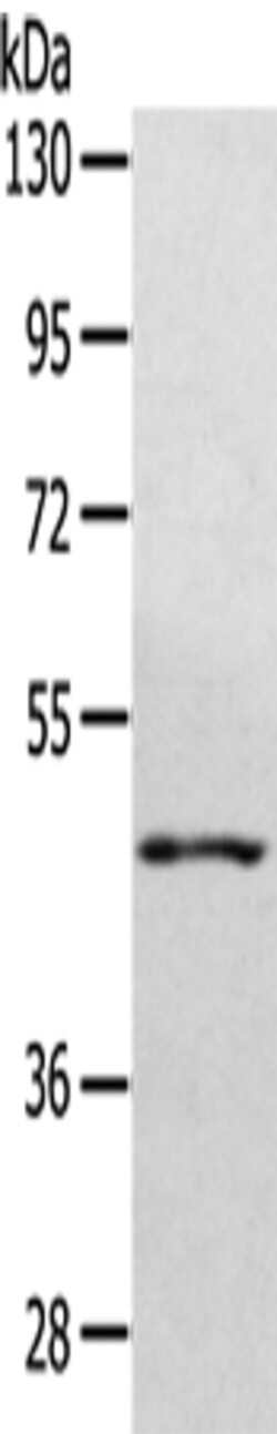 Invitrogen WDR4 Polyclonal Antibody 100 &mu;L | Buy Online | Invitrogen&trade; | Fisher Scientific
