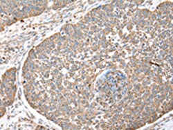 Invitrogen WDR85 Polyclonal Antibody 100 &mu;L; Unconjugated:Antibodies,