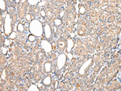 Invitrogen WDR85 Polyclonal Antibody 100 &mu;L; Unconjugated:Antibodies,