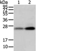 Invitrogen WFDC5 Polyclonal Antibody 100 &mu;L; Unconjugated:Antibodies,