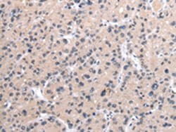 Invitrogen MORC2 Polyclonal Antibody 100 &mu;L; Unconjugated:Antibodies,