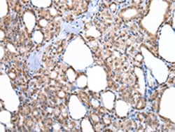 Invitrogen MORC2 Polyclonal Antibody 100 &mu;L; Unconjugated:Antibodies,