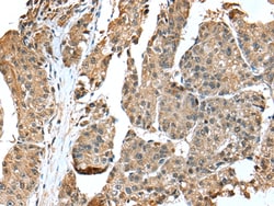 Invitrogen EML4 Polyclonal Antibody 100 &mu;L | Buy Online | Invitrogen&trade; | Fisher Scientific