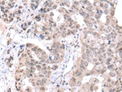 Invitrogen PCID2 Polyclonal Antibody 100 &mu;L; Unconjugated:Antibodies,
