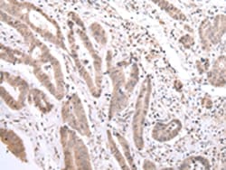 Invitrogen PCID2 Polyclonal Antibody 100 &mu;L; Unconjugated:Antibodies,