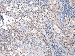 Invitrogen MMGT1 Polyclonal Antibody 100 &mu;L | Buy Online | Invitrogen&trade; | Fisher Scientific