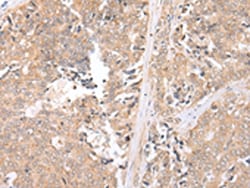 Invitrogen&trade;&nbsp;MMGT1 Polyclonal Antibody