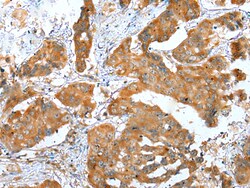 Invitrogen ERMP1 Polyclonal Antibody 100 &mu;L; Unconjugated:Antibodies,