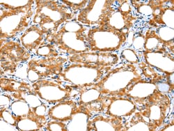 Invitrogen ERMP1 Polyclonal Antibody 100 &mu;L; Unconjugated:Antibodies,