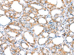 Invitrogen MYBPHL Polyclonal Antibody 100 &mu;L; Unconjugated:Antibodies,