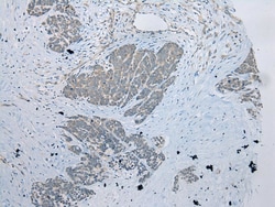 Invitrogen UBXN2B Polyclonal Antibody 100 &mu;L; Unconjugated:Antibodies,