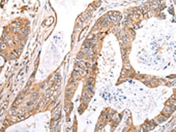 Invitrogen KCTD16 Polyclonal Antibody 100 &mu;L; Unconjugated:Antibodies,