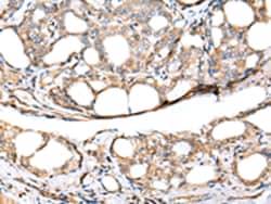 Invitrogen KCTD16 Polyclonal Antibody 100 &mu;L; Unconjugated:Antibodies,