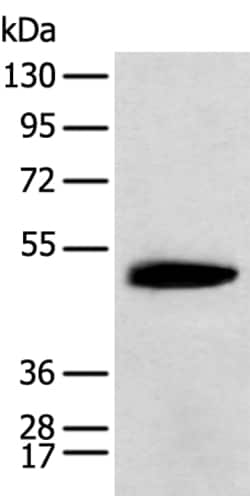 Invitrogen KCTD16 Polyclonal Antibody 100 &mu;L; Unconjugated:Antibodies,