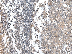 Invitrogen PRG3 Polyclonal Antibody 100 &mu;L; Unconjugated:Antibodies,