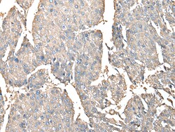 Invitrogen PRSS38 Polyclonal Antibody 100 &mu;L; Unconjugated:Antibodies,