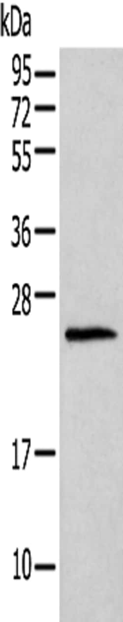 Invitrogen Histone H1T Polyclonal Antibody 100 &mu;L | Buy Online | Invitrogen&trade; | Fisher Scientific