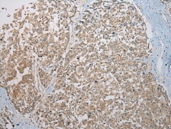 Invitrogen Kazrin Polyclonal Antibody 100 &mu;L; Unconjugated:Antibodies,