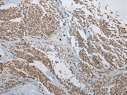 Invitrogen Kazrin Polyclonal Antibody 100 &mu;L; Unconjugated:Antibodies,