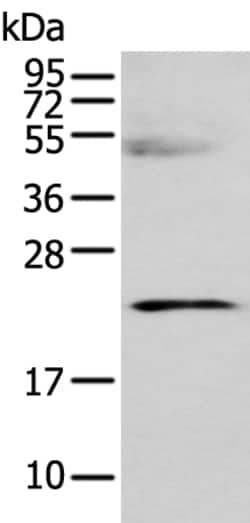 Invitrogen C8G Polyclonal Antibody 100 &mu;L; Unconjugated:Antikörper