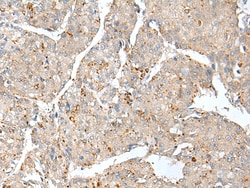 Invitrogen THEM5 Polyclonal Antibody 100 &mu;L; Unconjugated:Antibodies,