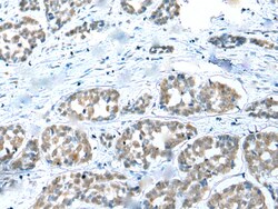 Invitrogen COMMD6 Polyclonal Antibody 100 &mu;L; Unconjugated:Antibodies,