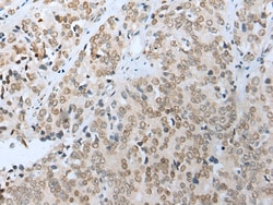 Invitrogen COMMD6 Polyclonal Antibody 100 &mu;L; Unconjugated:Antibodies,