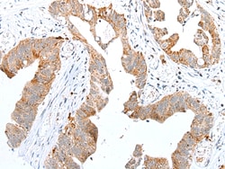 Invitrogen RhoV Polyclonal Antibody 100 &mu;L; Unconjugated:Antibodies,