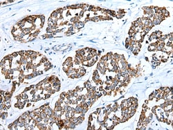 Invitrogen RhoV Polyclonal Antibody 100 &mu;L; Unconjugated:Antibodies,