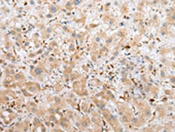 Invitrogen NPL Polyclonal Antibody 100 &mu;L; Unconjugated:Antibodies,