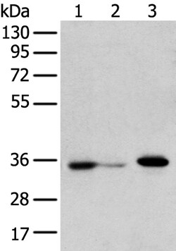 Invitrogen DHRSX Polyclonal Antibody 100 &mu;L; Unconjugated:Antibodies,