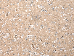 Invitrogen RFK Polyclonal Antibody 100 &mu;L; Unconjugated:Antibodies,