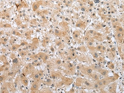 Invitrogen RFK Polyclonal Antibody 100 &mu;L; Unconjugated:Antibodies,