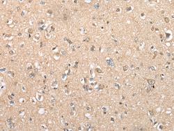 Invitrogen DYDC2 Polyclonal Antibody 100 &mu;L; Unconjugated:Antibodies,
