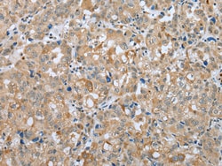 Invitrogen PLA2G4D Polyclonal Antibody 100 &mu;L; Unconjugated:Antibodies,