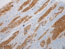 Invitrogen GSTM4 Polyclonal Antibody 100 &mu;L; Unconjugated:Antibodies,