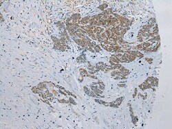 Invitrogen GSTM4 Polyclonal Antibody 100 &mu;L; Unconjugated:Antibodies,
