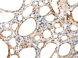 Invitrogen HEATR2 Polyclonal Antibody 100 &mu;L; Unconjugated:Antibodies,
