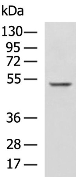 Invitrogen Znf672 Polyclonal Antibody 100 &mu;L | Buy Online | Invitrogen&trade; | Fisher Scientific