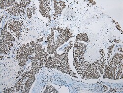 Invitrogen ZNF22 Polyclonal Antibody 100 &mu;L; Unconjugated:Antibodies,