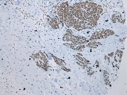 Invitrogen ZNF22 Polyclonal Antibody 100 &mu;L; Unconjugated:Antibodies,