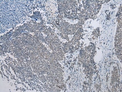 Invitrogen NAT15 Polyclonal Antibody 100 &mu;L; Unconjugated:Antibodies,