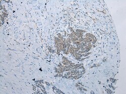 Invitrogen NAT15 Polyclonal Antibody 100 &mu;L; Unconjugated:Antibodies,