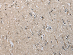 Invitrogen DECR2 Polyclonal Antibody 100 &mu;L; Unconjugated:Antibodies,