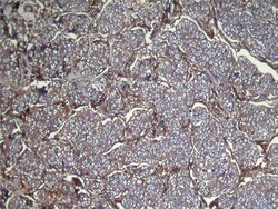 Invitrogen UGT3A1 Polyclonal Antibody 100 &mu;L; Unconjugated:Antibodies,