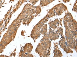 Invitrogen ASB9 Polyclonal Antibody 100 &mu;L; Unconjugated:Antibodies,