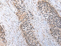Invitrogen C1QB Polyclonal Antibody 100 &mu;L; Unconjugated:Antibodies,